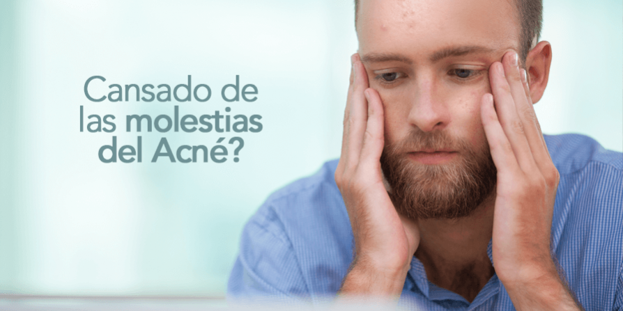 Cansado de las molestias del Acné?