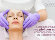 Limpieza profunda para piel con acné